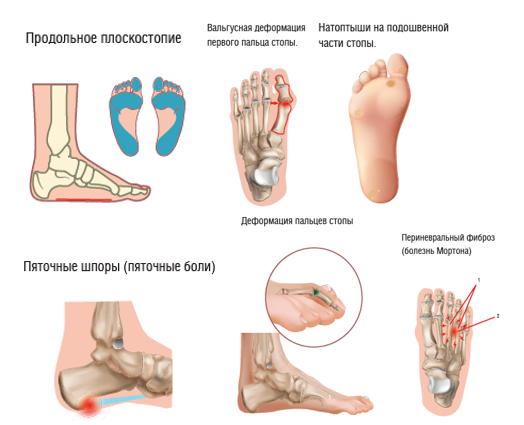 Травмы в фигурном катании